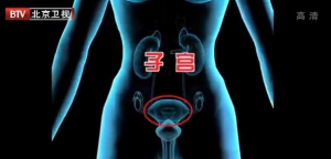 我是大医生20140415视频和笔记:《宫颈里的混战》女性护理液,宫颈糜烂,宫颈癌