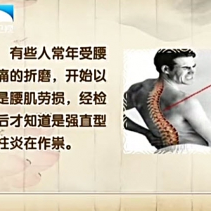 饮食养生汇20140423视频和笔记:张春艳讲《强直性脊柱炎的防与护》椰丝虾饼