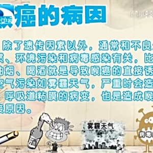 饮食养生汇20140424视频和笔记:陈晓红讲《喉癌早发现》,喉癌的类型,四宝酿香菇