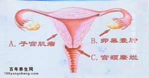《健康之路》20140520视频和笔记:段华讲女性健康晴雨表（上）你的月经正常吗