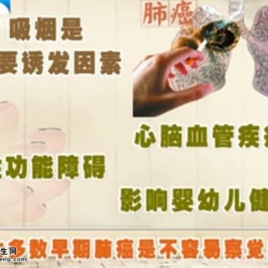 饮食养生汇20140520视频和笔记:支修益讲《肺-你要好好的》肺癌,胸部CT筛查