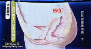 《健康之路》20140522视频和笔记:段华讲女性健康晴雨表（下）痛经,子宫内膜异位症,不孕