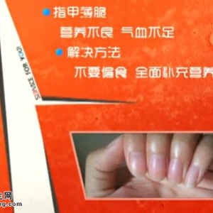 家政女皇20140529视频和笔记:吴大真讲透过指甲看健康,指甲颜色透露的疾病征兆