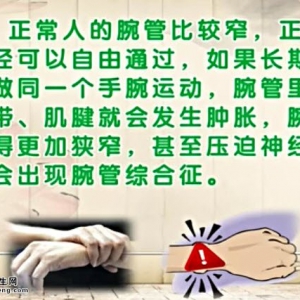 饮食养生汇20140529视频和笔记:张黎讲腕管综合征、什锦烩豆腐