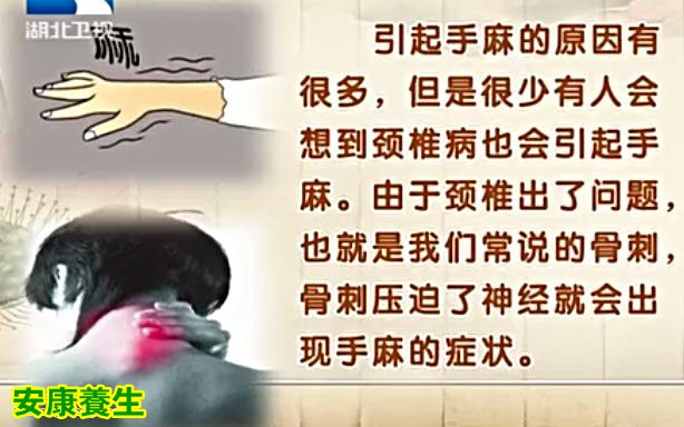 肌肉的紧张痉挛也可能压迫神经，从而导致手麻