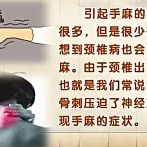 饮食养生汇20140603视频和笔记:付国兵讲《都是颈椎惹的祸-手麻》颈椎病,手麻,瑶柱冬瓜 ...