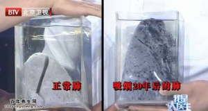 20140603我是大医生视频和笔记:吸烟的危害,闭塞性脉管炎,煤渣肺,尼古丁