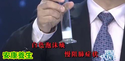 慢性支气管炎会出现白色泡沫痰