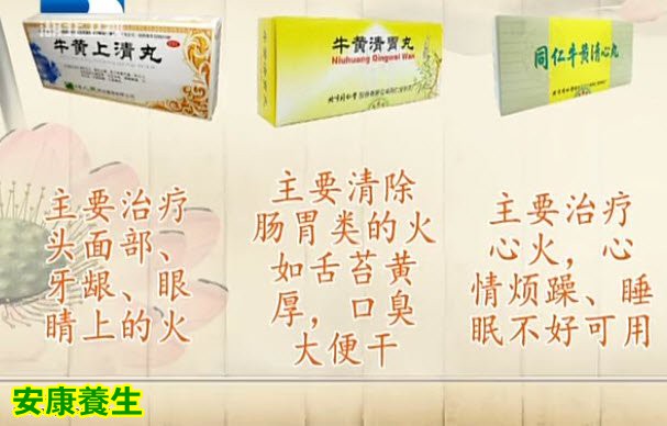 不同部位上火引起的症状