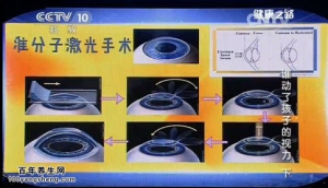 《健康之路》20140620视频和笔记：吴小影讲谁动了孩子的视力（下）