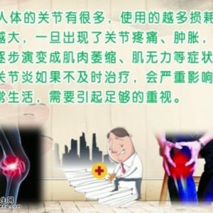 饮食养生汇20140703视频和笔记:秦新艳讲骨关节炎的治疗,发病因素,黄金鱼排
