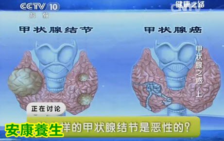 甲状腺突然长大或者淋巴结肿大、吞咽困难、呼吸困难、声音嘶哑要高度警惕甲状腺结节癌变