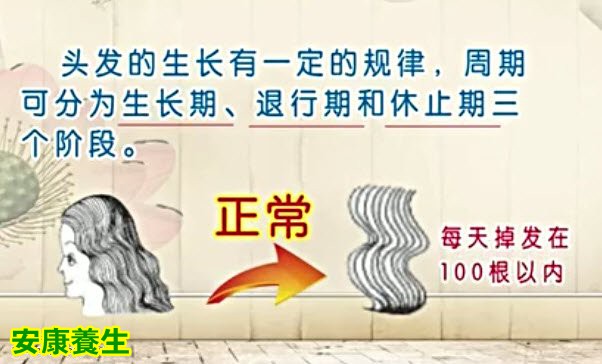 每天掉发在100根以内都属于生理性脱发