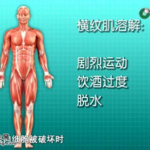 20140806健康007视频和笔记:沈雁英讲横纹肌溶解、重症肌无力症状