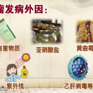 20140811饮食养生汇视频和笔记:杨国旺讲肿瘤的症状,肿瘤的发病外因,肿瘤的发病内因