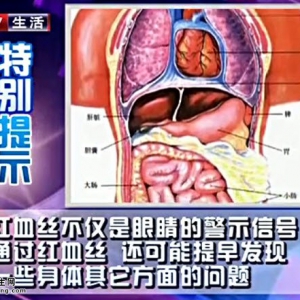 20140811健康生活视频和笔记:迟润华讲眼睛红血丝的原因、护眼茶的制作方法