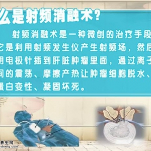 20140828饮食养生汇视频和笔记:潘杰讲肝癌治疗方法,射频消融术