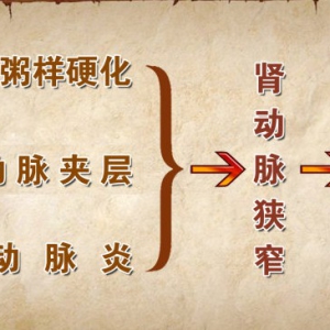 20140926《养生堂》视频和笔记:郭伟讲警惕血管带来的“压力”,肾动脉狭窄导,肾性高血压