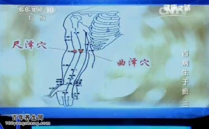 20140927《健康之路》 赵慧玲讲心脉瘀阻的表现,泻血治疗高血压,三七花茶,三红茶