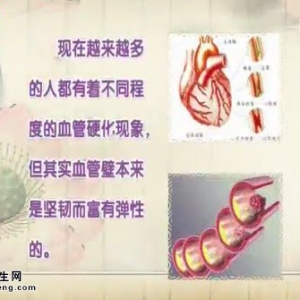 20140930饮食养生汇视频和笔记:金玫讲血管弹性变脆的原因,如何预防心脑血管疾病