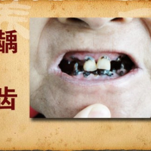 20141006《养生堂》视频:冯兴华,曹炜讲干燥综合征,加味玄麦甘桔汤,更年期口干舌燥的调理