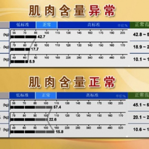 20141010《养生堂》视频笔记:孙明晓讲肌肉衰减型肥胖,蛋白质含量高的食物,少肌症