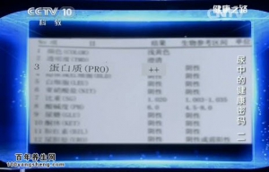20141015《健康之路》视频和笔记:张骞讲蛋白尿的危害、憋尿的危害、尿液气味预示的疾病