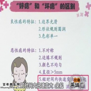 饮食养生汇20141027视频和笔记:陶娟讲黑色素瘤,导致黑色素瘤的原因,如何安全祛痣