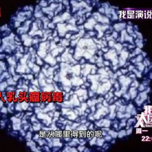 我是大医生20141027视频和笔记:人乳头瘤病毒,宫颈癌的原因,女性阴道示意图