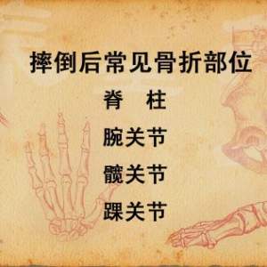 《养生堂》20141103视频和笔记:老人摔倒髋部骨折并发症、驼背是怎么回事