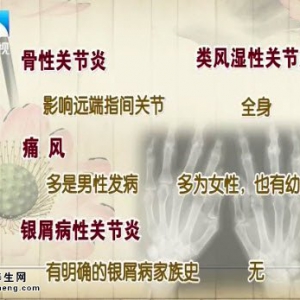 饮食养生汇20141103视频和笔记:秦新艳讲类风湿性关节炎治疗、五花肉炒芋头