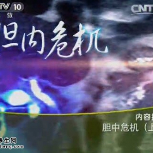 《健康之路》20141104视频和笔记:栗光明讲哪种生活习惯会引起胆结石,哪种食物能预防胆结石