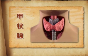 《养生堂》20141106视频笔记:刘绍严王  勇讲甲状腺病变的表现、甲状腺疾病的原因及治疗