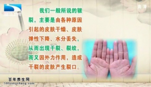 饮食养生汇20141117视频和笔记:魏爱华讲皮肤皲裂的原因、容易皲裂的治疗