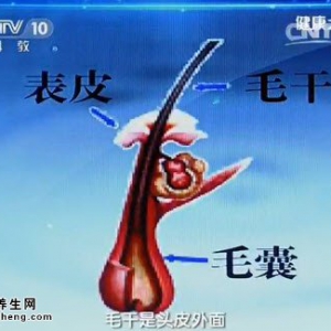 《健康之路》20141120视频笔记:魏爱华讲脱发的原因、脂溢性脱发的治疗