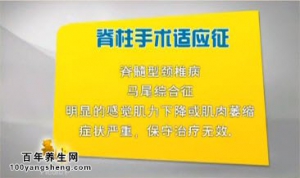 贵州卫视20141119养生视频和笔记：刘亚军讲颈椎病的种类和症状及治疗方法