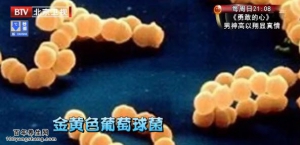 我是大医生20141201视频和笔记:王贵强讲白醋的妙用、煮鸡蛋的误区