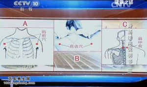 《健康之路》20141210视频:黄枢讲肩关节损伤的原因、肩周炎的症状和治疗