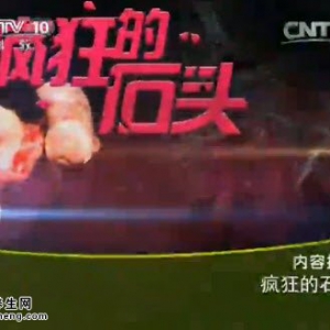 《健康之路》20141220视频笔记：肾结石的症状 空掌拍背排石法 微创激光碎石手术