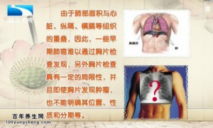 饮食养生汇20141223视频和笔记:王建军讲肺癌治疗的误区 肺癌化疗期间吃什么