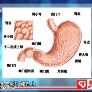 聚健康20150106视频和笔记:程凯讲急性胃扩张 足三里的功效 正确的刮痧方法