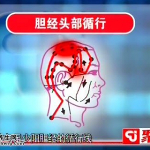 聚健康20150109视频和笔记:程凯讲偏头痛的疼痛特点 偏头痛的穴位缓解方法