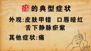 《养生堂》20150111视频和笔记:血瘀的表现及典型症状  脾肾两虚的表现及调理