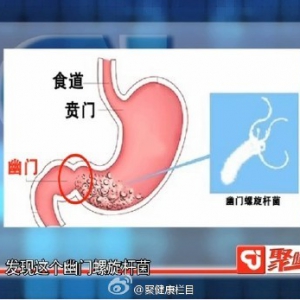 聚健康20150115视频和笔记:魏玮讲口臭预示的疾病 什么是丝绸之路病