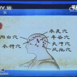 《健康之路》20150123视频和笔记:王麟鹏讲针灸治疗头痛 拔罐缓解感冒头痛