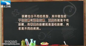 饮食养生汇20150204视频和笔记:咳嗽的分类 咳嗽的误区 诱发咳嗽的主要因素