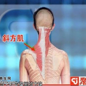 聚健康20150206视频和笔记:缓解落枕的禁忌 缓解落枕的小妙招