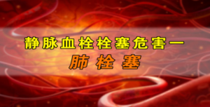《养生堂》20150306视频和笔记:静脉血管病变 静脉血栓的高发人群 静脉血栓的预防
