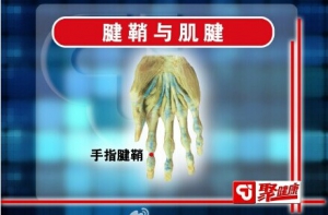 聚健康20150309视频和笔记:腱鞘炎的症状特点 腱鞘炎诱发原因 腱鞘炎的治疗及预防