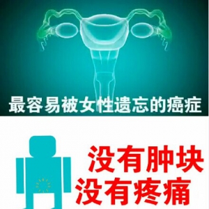 艾问常识20150318视频和笔记:纪小龙讲卵巢癌的症状表现 卵巢癌的预防及自检